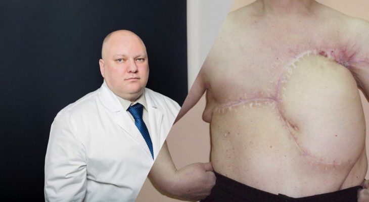 Выживают с раком четвертой степени: врачи из Ярославля показали фото 