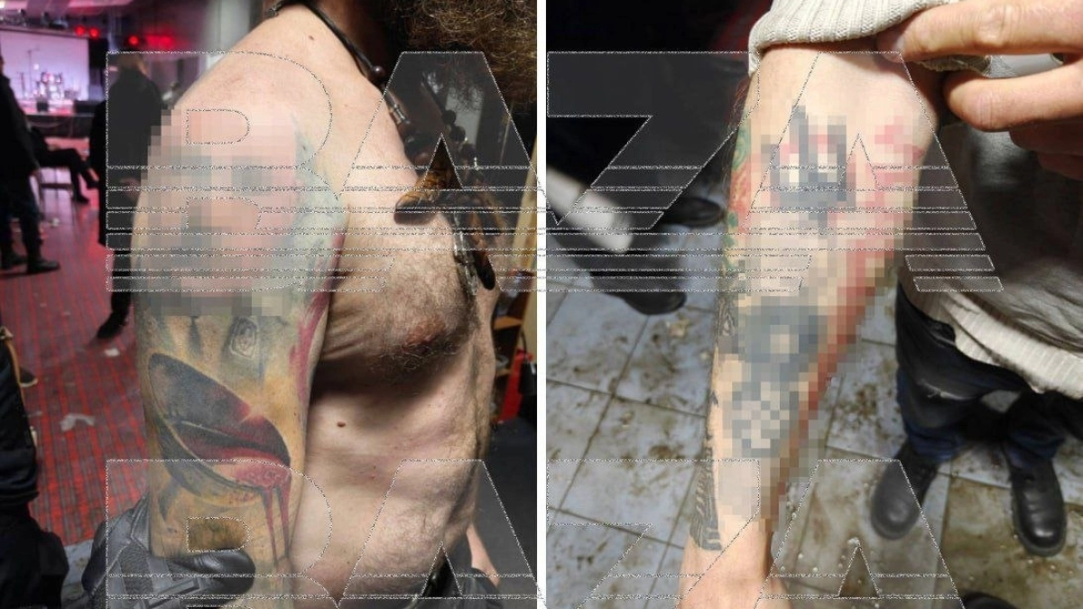 Участник разогнанного рок-концерта в Брагино пообещал свести запрещённые татуировки