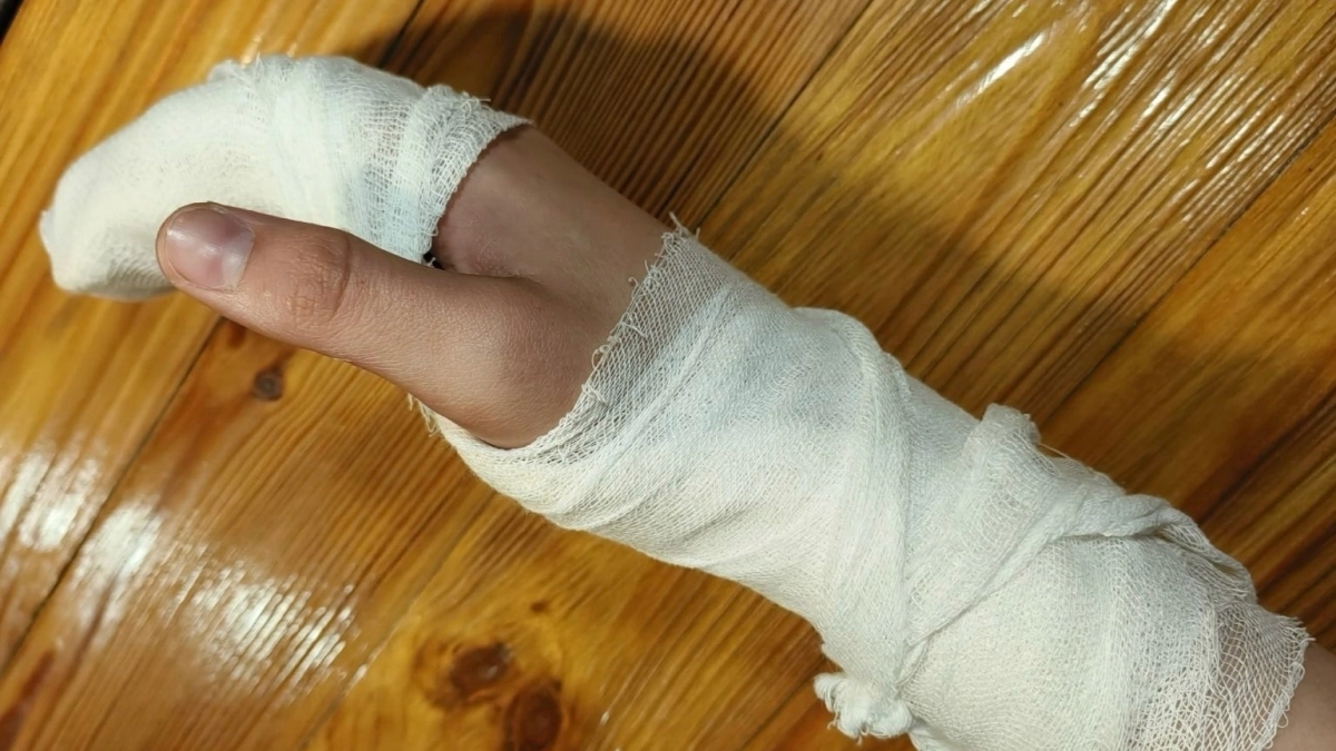 В Рыбинске 12‑летний школьник получил открытый перелом пальца на тренажере: "Посмотреть бы в глаза этим конструкторам"