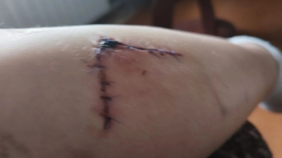 В Гаврилов-Яме  искусала ребёнка, женщину и участкового