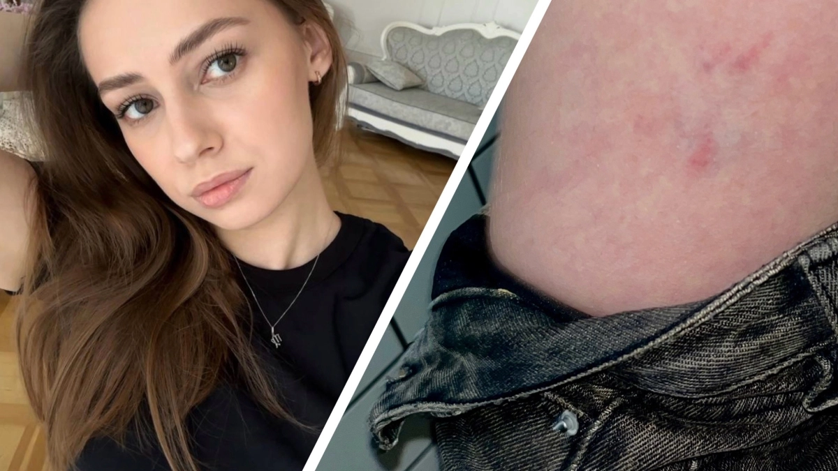 Ярославского фотографа укусила бродячая собака: девушка провела съемку и поехала в травмпункт