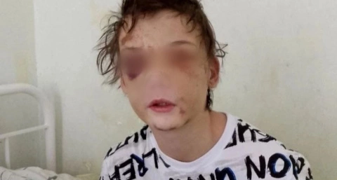 В защиту избитого до полусмерти подростка ярославцы создали петицию: "Мы челюсть ему сломали"