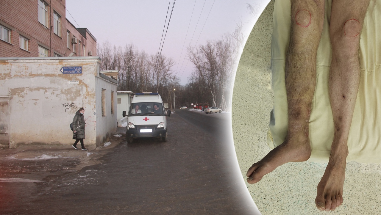 Чудо-технологии: врачи в Ярославле научились делать ноги длиннее