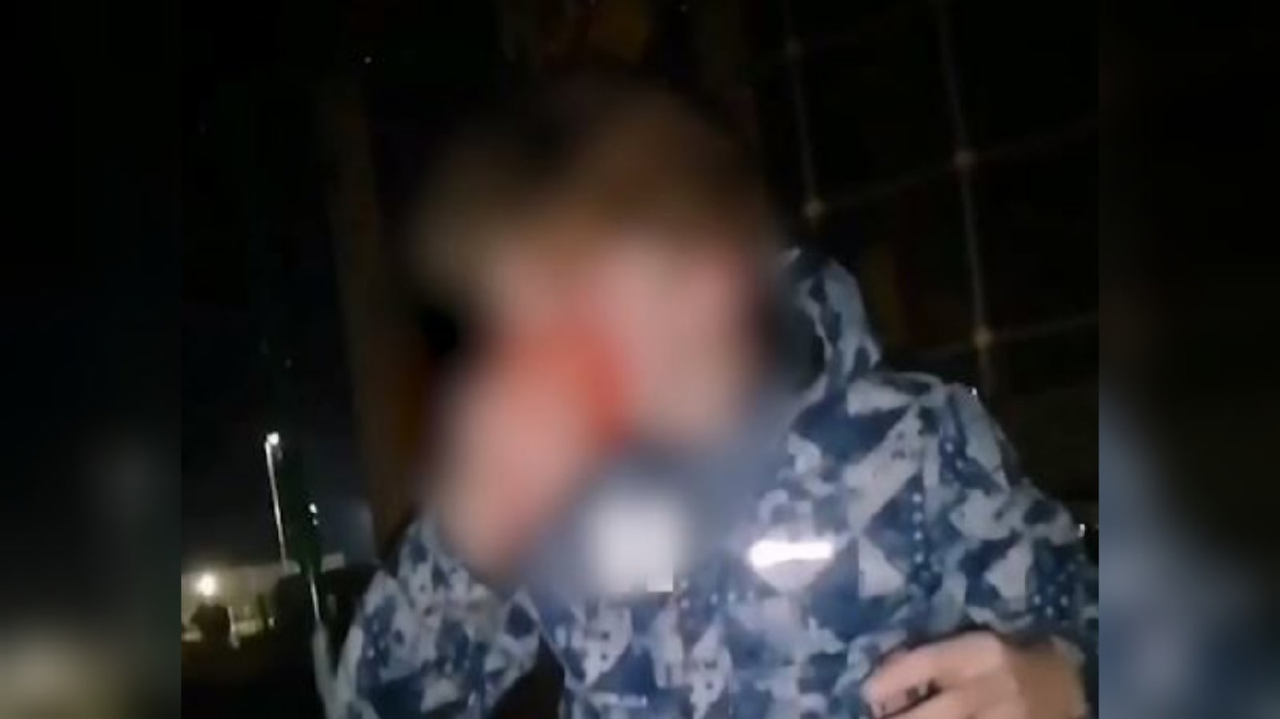 Все лицо было залито кровью: под Ярославлем жестоко избили подростка