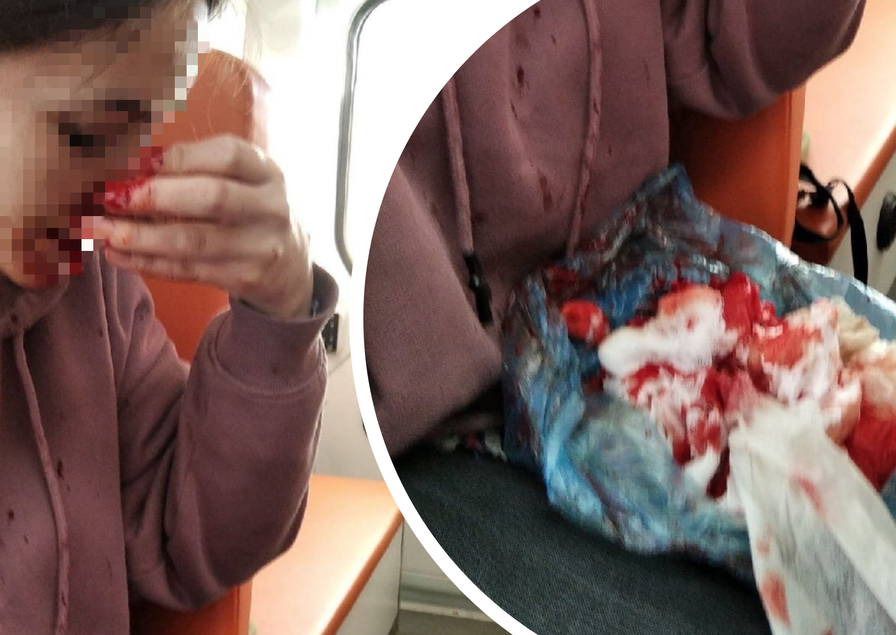 «Боялась не доехать»: из-за открывшегося в поезде кровотечения ярославна попала в больницу