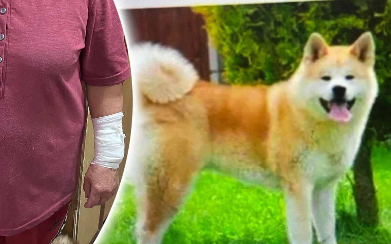 "У бабушки рваная рана": собака напала на пятерых жителей Красноперекопского района