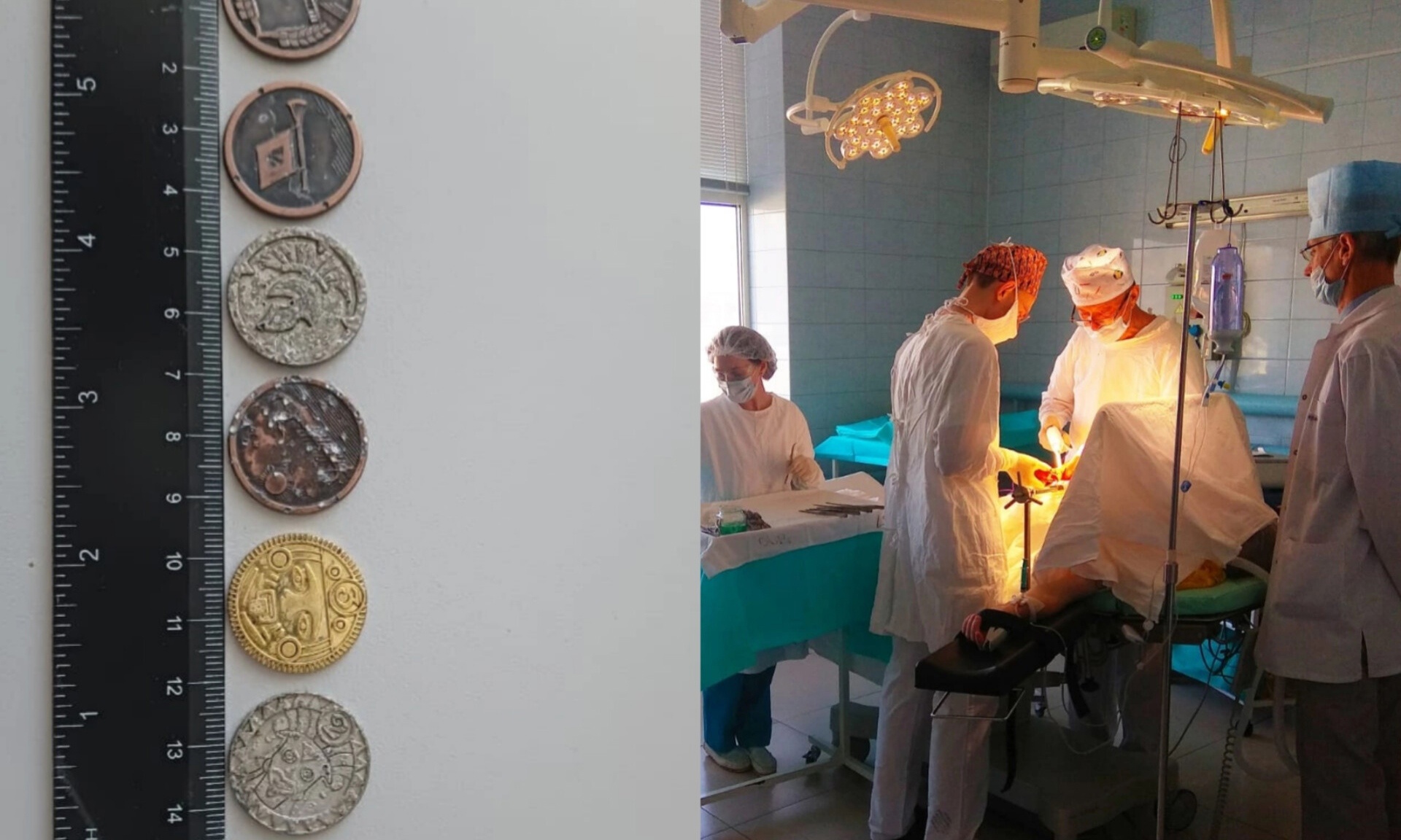  В Ярославле 8 детей попали на стол хирургов из-за монеток торговой сети